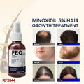 FEG Hair Growth Spray – Natural Anti - Hair Loss (50ml) - NineMillions