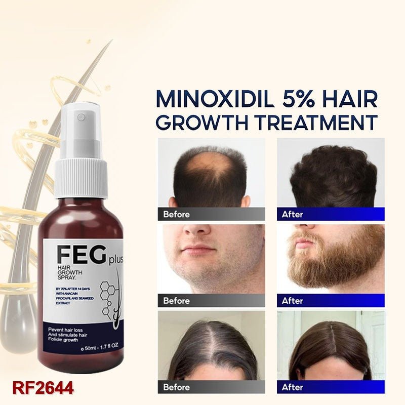 FEG Hair Growth Spray – Natural Anti - Hair Loss (50ml) - NineMillions