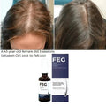 FEG Hair Growth Spray – Natural Anti - Hair Loss (50ml) - NineMillions