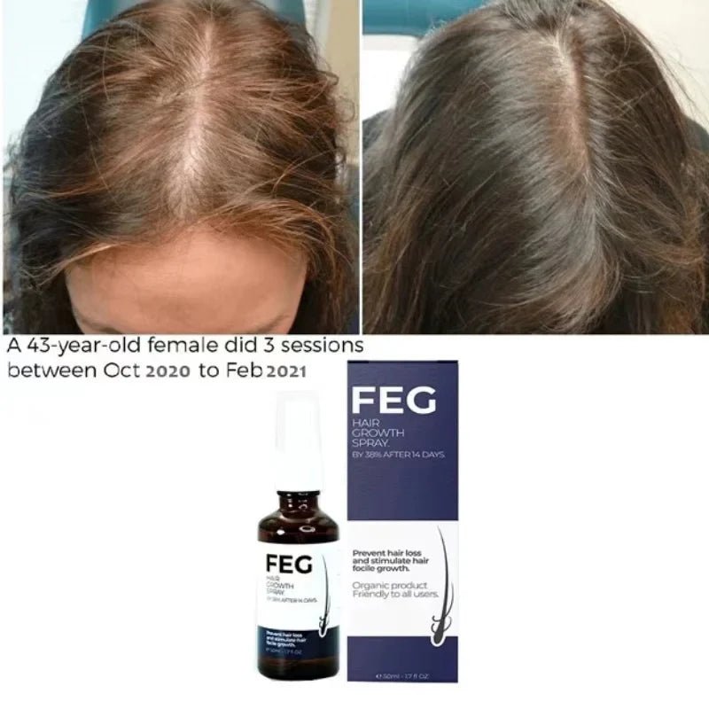 FEG Hair Growth Spray – Natural Anti - Hair Loss (50ml) - NineMillions